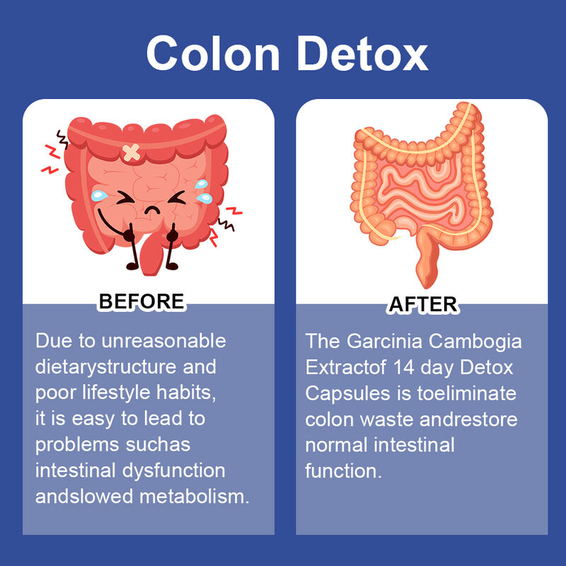 Complément alimentaire détoxifiant en capsules pour la perte de poids et le soutien de la santé digestive, marque privée, 14 jours